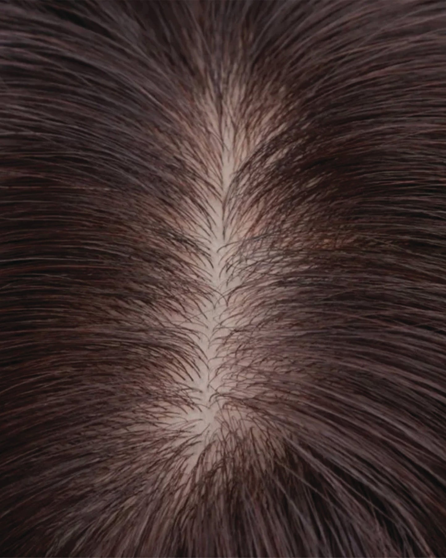 Luxury Silk Base Hair Topper – Seamless Natural Coverage
